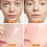 Volcanic Stone Facial Roller – Oil Control & Skin Rejuvenation - Image 5