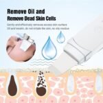 Ultrasonic Deep-Clean Skin Scrubber & Blackhead Remover - Image 4