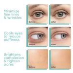 3D Ice Roller Facial Massager: Skin Lifting & Soothing Cool Globes - Image 5