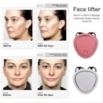 Non-Surgical Face Lifting & Skin Tightening Microcurrent Massager Set - Image 4