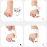 ComfortAlign 2Pcs Hallux Valgus and Bunion Corrector – Orthopedic Toe Separator and Foot Care Solution - Image 5